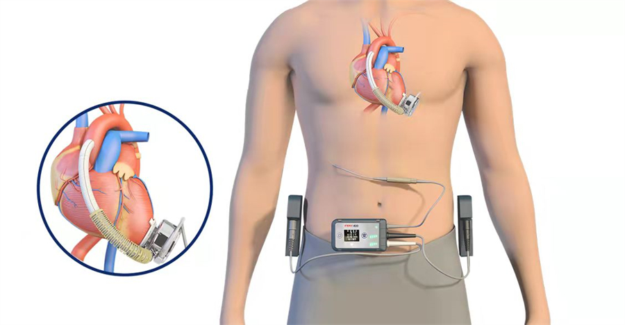 1676530772493039v3hb.jpg ΢ÐÅͼƬ_20211126124921.jpg